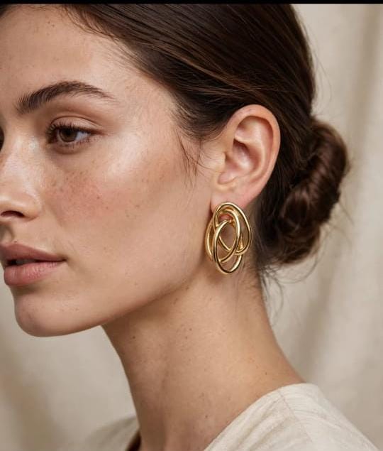 ARETE IRREGULAR